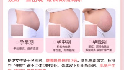 Mamaamp;Kids防妊娠纹滋润乳霜怎样?通过SGS权威检测