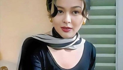 62岁关之琳现身韩国，脸部馒化颧骨凸出，戴黄金手镯 穿名牌好贵气