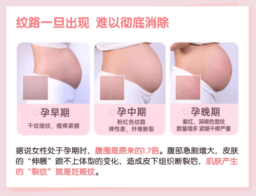 Mama&amp;Kids防妊娠纹滋润乳霜怎样?通过SGS权威检测